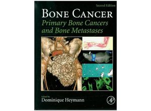 9780124167216 - Bone Cancer Gebunden