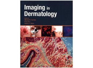 9780128028384 - Imaging in Dermatology - Michael Hamblin Kartoniert (TB)