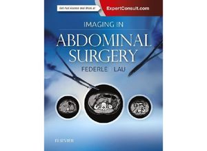 9780323611350 - Imaging in Abdominal Surgery - Michael P Federle James Lau Gebunden