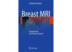 9781441965202 - Breast MRI - R Edward Hendrick Kartoniert (TB)