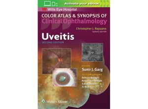 9781496363008 - Uveitis (Color Atlas and Synopsis of Clinical Ophthalmology) - Sunir Garg Kartoniert (TB)