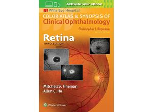 9781496363084 - Retina (Color Atlas and Synopsis of Clinical Ophthalmology) - Mitchell S Fineman Allen C Ho Kartoniert (TB)