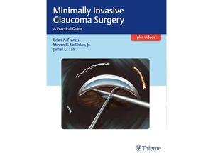 9781626231566 - Minimally Invasive Glaucoma Surgery - Brian Francis Steven Sarkisian James C Tan Gebunden