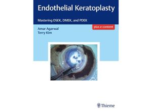 9781626234512 - Endothelial Keratoplasty - Amar Agarwal Terry Kim Gebunden