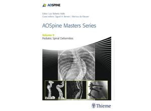 9781626234536 - AOSpine Masters Series Volume 9 Pediatric Spinal Deformities Gebunden