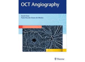 9781626234734 - OCT Angiography - David Chow Gebunden