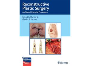 9781626235175 - Reconstructive Plastic Surgery - Robert Murphy Charles Herman Gebunden