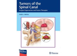 9781626239319 - Tumors of the Spinal Canal - Ankit I Mehta Gebunden