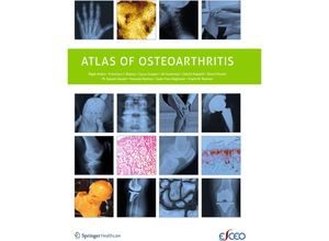 9781910315156 - Atlas of Osteoarthritis - Nigel Arden Francisco Blanco C Cooper Kartoniert (TB)