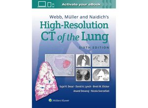 9781975144432 - Webb Muller and Naidichs High Resolution of Lung CT - Sujal Desai David A Lynch Brett M Elicker Anand Devaraj Nicola Sverzellati Gebunden