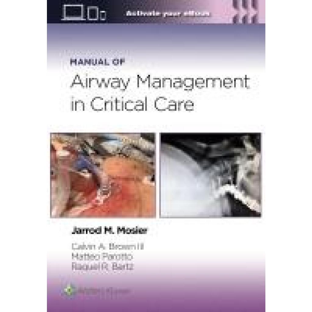 9781975214203 - Mosier Jarrod Manual of Airway Management in Critical Care Print + eBook with Multimedia