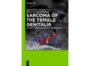 9783110351415 - Sarcoma of the Female Genitalia   Volume 1   Smooth muscle and stromal tumors and prevention of inadequate surgeryVol1 - Günter Köhler Matthias Evert Katja Evert Marek Zygmunt Gebunden