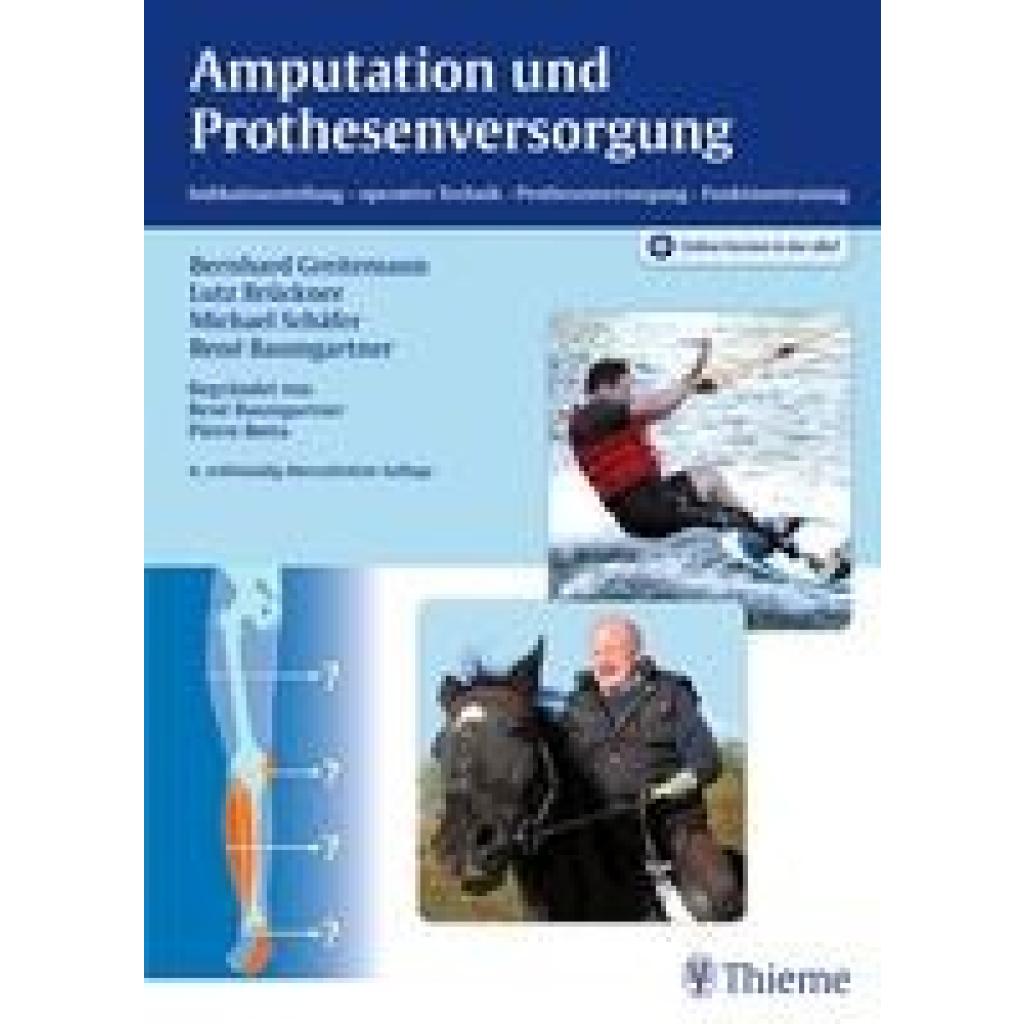 9783131361547 - Amputation und Prothesenversorgung