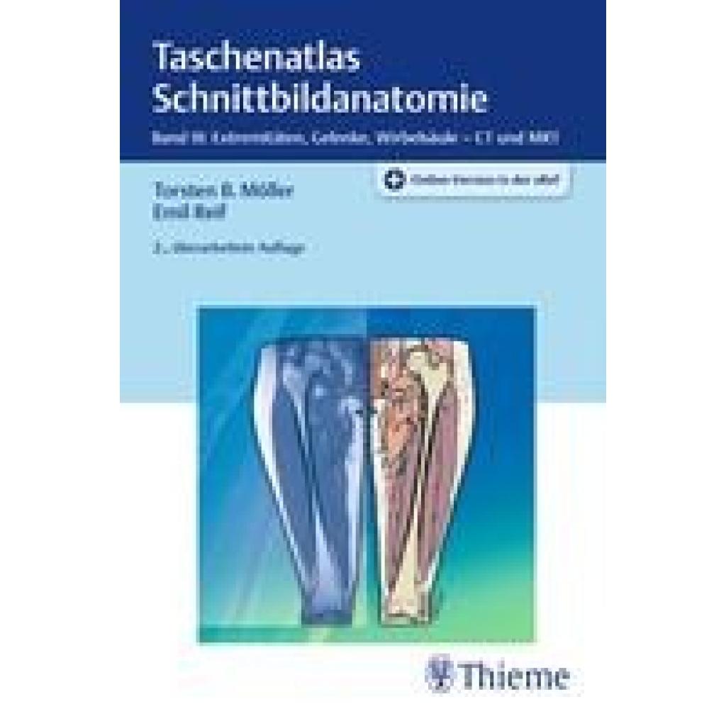 9783131392626 - Möller Torsten Bert Taschenatlas Schnittbildanatomie 03