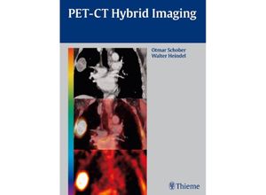 9783131488619 - PET-CT Hybrid Imaging - Otmar Schober Walter Heindel Gebunden