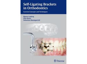 9783131547019 - Self-ligating Brackets in Orthodontics - Björn Ludwig Dirk Bister Sebastian Baumgärtel Gebunden