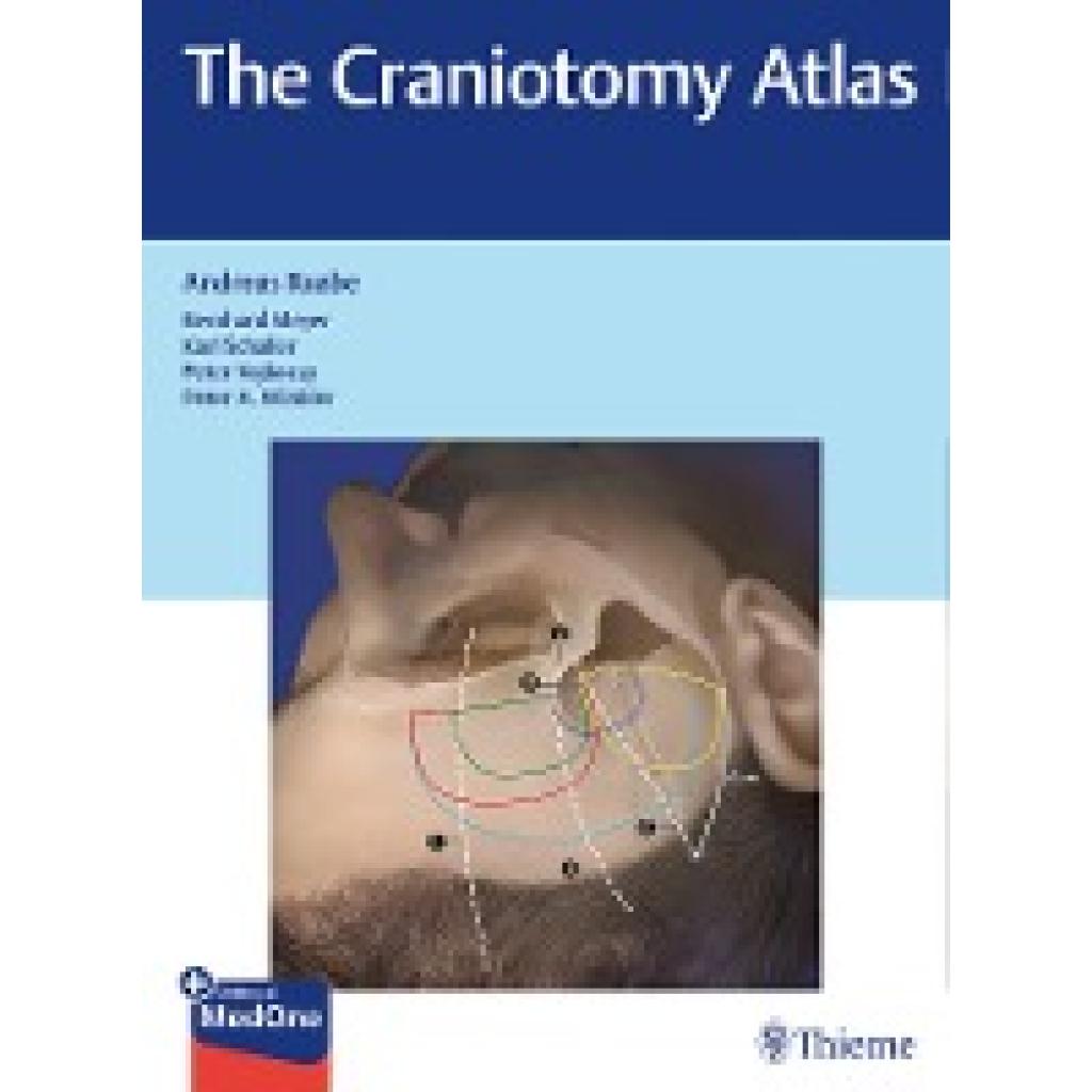 9783132057913 - The Craniotomy Atlas