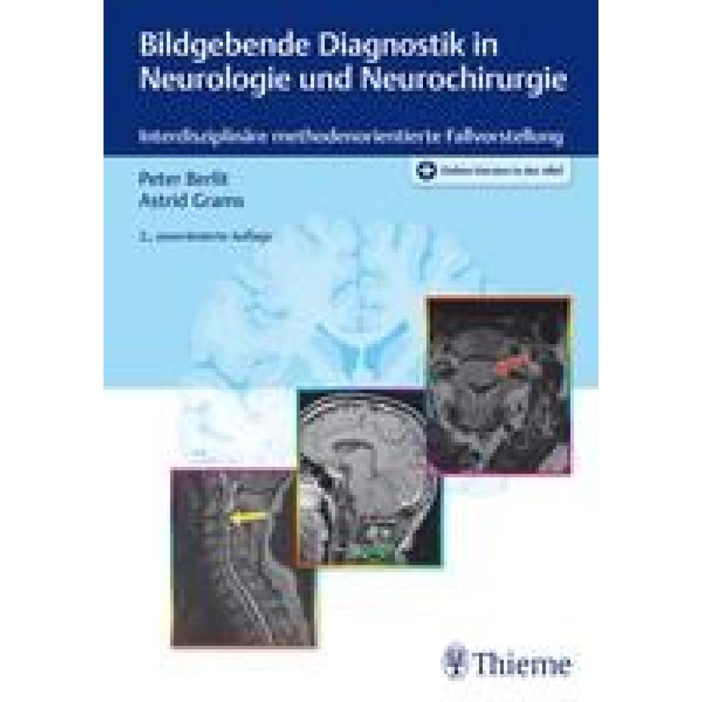 9783132406155 - Berlit Peter-Dirk Bildgebende Diagnostik in Neurologie und Neurochirurgie