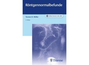 9783132428287 - Röntgennormalbefunde - Torsten B Möller Kartoniert (TB)