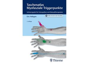 9783132432338 - Taschenatlas Myofasziale Triggerpunkte - Eric Hebgen Kartoniert (TB)