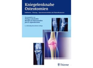 9783132446137 - Kniegelenknahe Osteotomien Gebunden