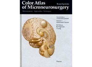 9783136660027 - Color Atlas of Microneurosurgery Volume 1 - Intracranial Tumors - Robert F Spetzler Wolfgang Th Koos Johannes Lang Leinen