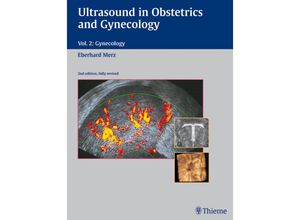 9783137544029 - Ultrasound in Obstetrics and Gynecology 2 Gynecology Gebunden