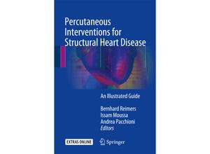 9783319437552 - Percutaneous Interventions for Structural Heart Disease Kartoniert (TB)