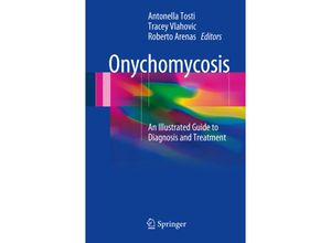 9783319448527 - Onychomycosis Kartoniert (TB)