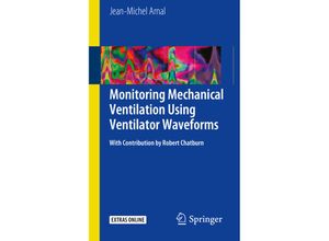 9783319586540 - Monitoring Mechanical Ventilation Using Ventilator Waveforms - Jean-Michel Arnal Kartoniert (TB)