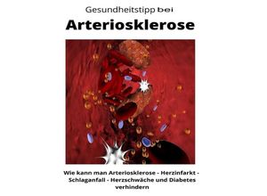 9783347760394 - Gesundheitstipp bei Arteriosklerose - Maximilian Loidl Kartoniert (TB)