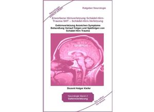 9783347968899 - Erworbene Hirnverletzung Schädel-Hirn-Trauma SHT - Schädel-Hirn-Verletzung - Rehabilitation - für Patienten Angehörige medizinisches Personal - Holger Kiefer Kartoniert (TB)