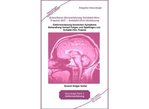 9783347968929 - Erworbene Hirnverletzung Schädel-Hirn-Trauma SHT - Schädel-Hirn-Verletzung - Rehabilitation - für Patienten Angehörige medizinisches Personal - Holger Kiefer Kartoniert (TB)