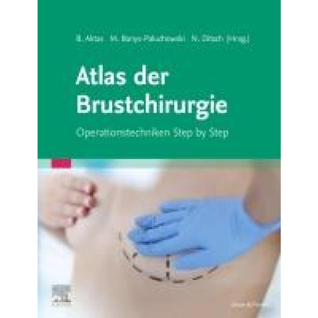 9783437150227 - Onkoplastische und rekonstruktive Brustchirurgie