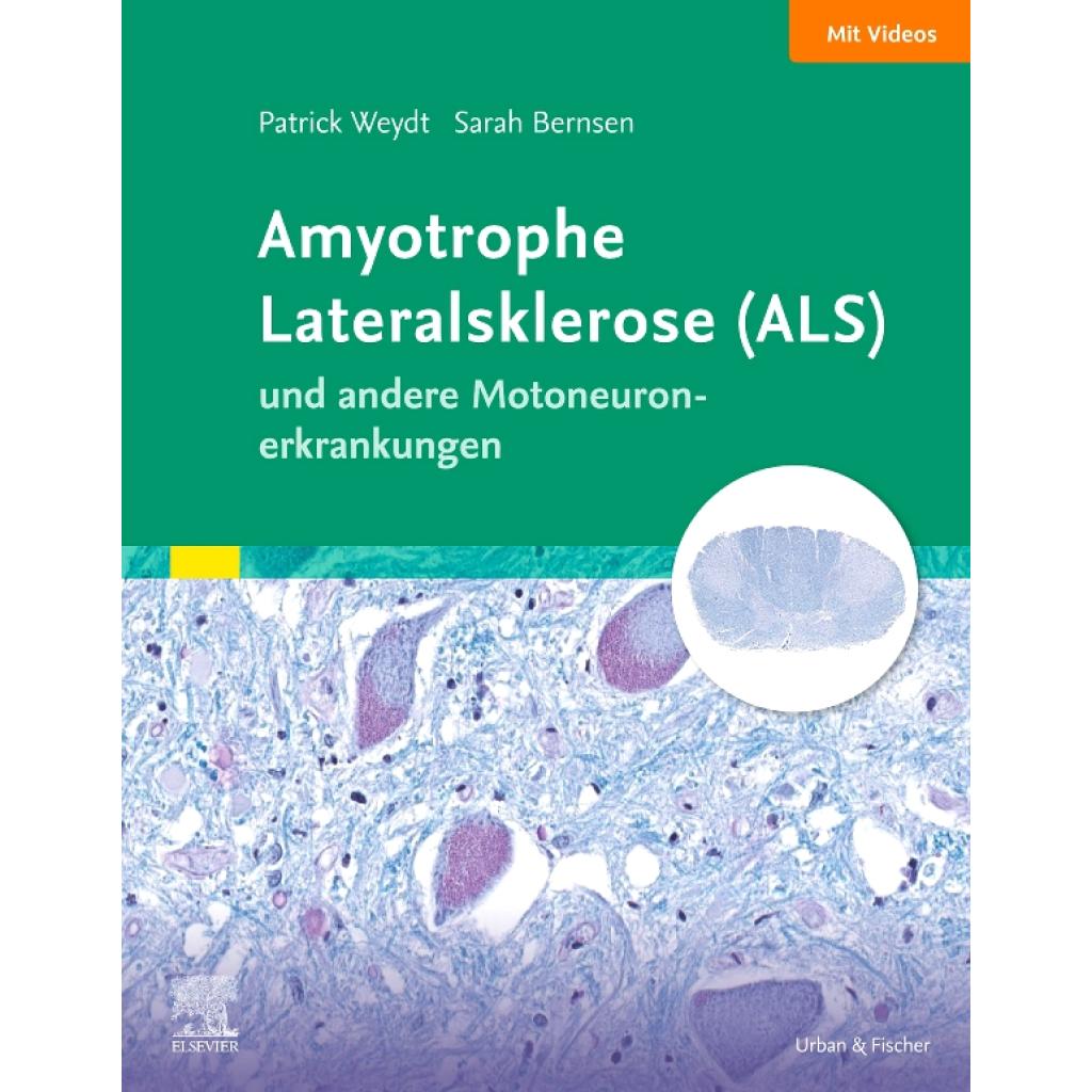 9783437217814 - Weydt Patrick Amyotrophe Lateralsklerose (ALS) und andere Motoneuronerkrankungen