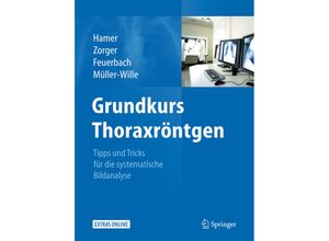 9783642177903 - Grundkurs Thoraxröntgen - Okka Hamer Niels Zorger Stefan Feuerbach René Müller-Wille Gebunden