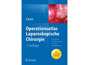 9783642312458 - Operationsatlas Laparoskopische Chirurgie - Thomas Carus Gebunden