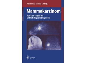 9783642804397 - Mammakarzinom Kartoniert (TB)