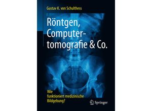 9783662539309 - Röntgen Computertomografie & Co - Gustav K von Schulthess Kartoniert (TB)