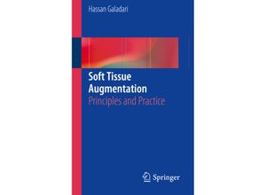 9783662558423 - Soft Tissue Augmentation w DVD - Hassan Galadari Kartoniert (TB)