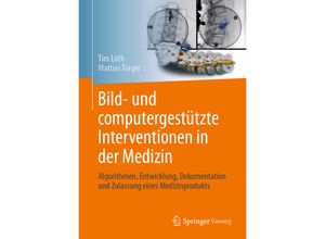 9783662673201 - Bild- und computergestützte Interventionen in der Medizin - Tim Christian Lüth Mattias Felix Träger Gebunden