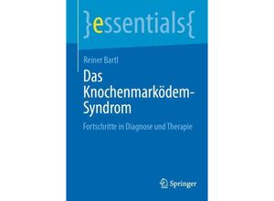 9783662690130 - Das Knochenmarködem-Syndrom - Reiner Bartl Kartoniert (TB)