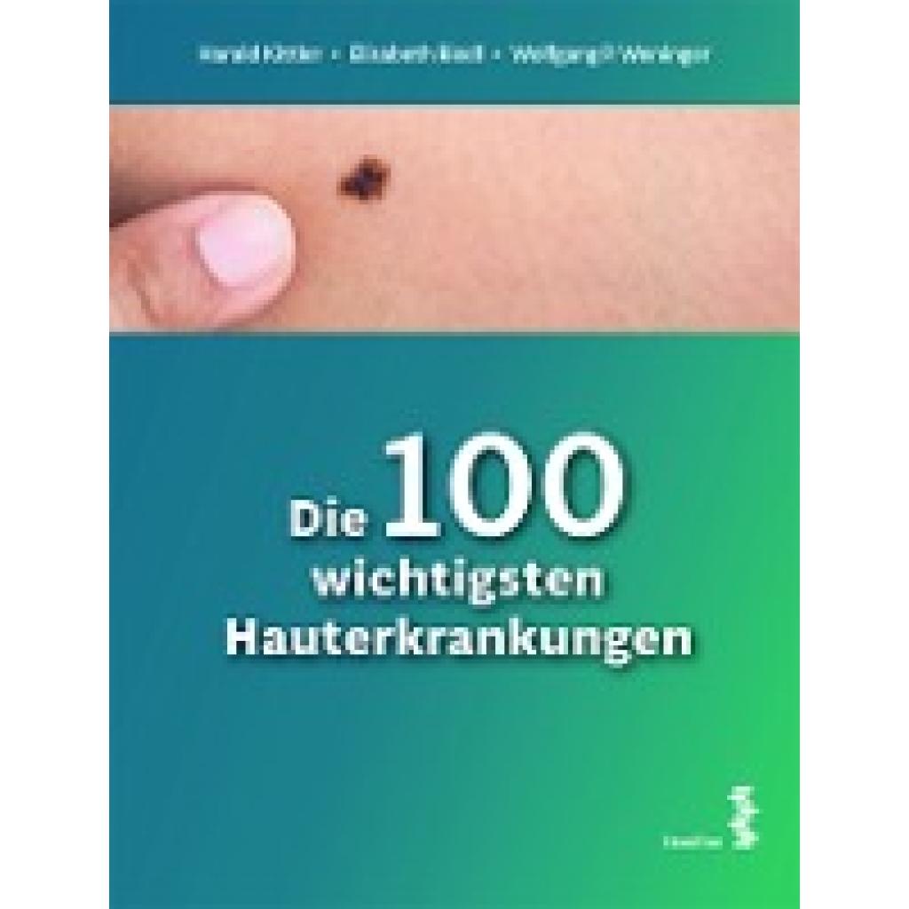 9783708923147 - Kittler Harald Die 100 wichtigsten Hauterkrankungen