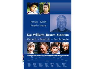 9783737543002 - Das Williams-Beuren-Syndrom - Rainer Pankau Angela Gosch Armin Wessel Carl-Joachim Partsch Kartoniert (TB)