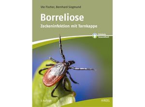 9783777628165 - Borreliose - Ute Fischer Bernhard Siegmund Kartoniert (TB)