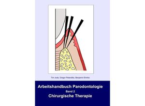 9783837046359 - Arbeitshandbuch Parodontologie Bd2 Arbeitshandbuch Parodontologie - Tim Joda Gregor Petersilka Benjamin Ehmke Kartoniert (TB)