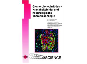 9783837416541 - UNI-MED Science   Glomerulonephritiden - Krankheitsbilder und nephrologische Therapiekonzepte - Janina Müller-Deile Mario Schiffer Gebunden