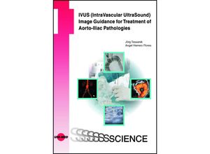 9783837416640 - UNI-MED Science   IVUS (IntraVascular UltraSound) Image Guidance for Treatment of Aorto-Iliac Pathologies - Jörg Teßarek Angel Herrero Flores Gebunden