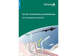 9783865415127 - Von der Tracheotomie zur Dekanülierung Kartoniert (TB)