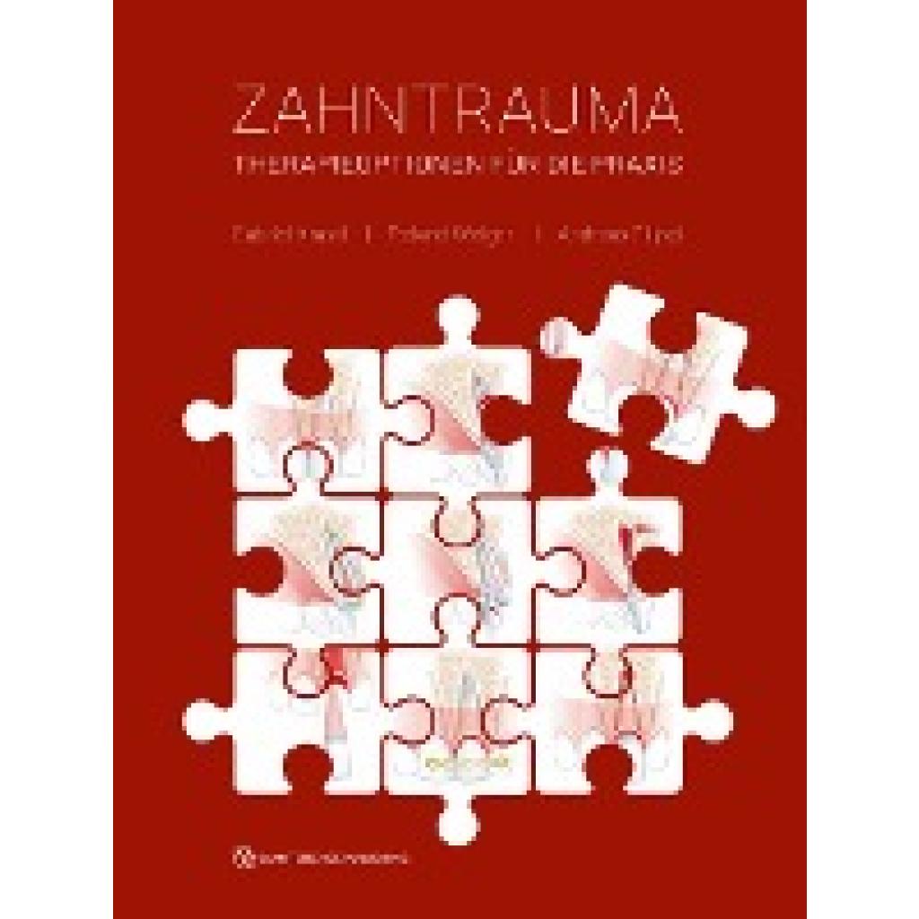 9783868675016 - Krastl Gabriel Zahntrauma